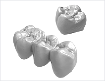 Crown y Coping