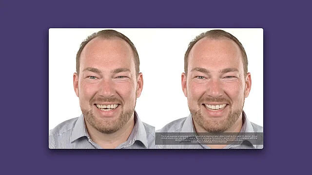 TruSmile Video y TruSmile Photo